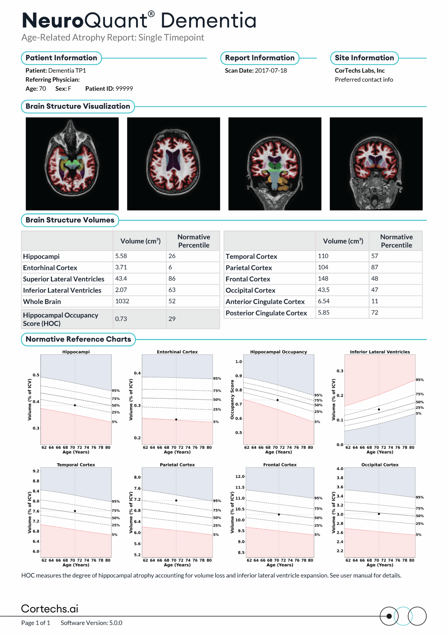 Neurowquant Unlocking the Value of NeuroQuant Reports: Different Use Cases Across ...
