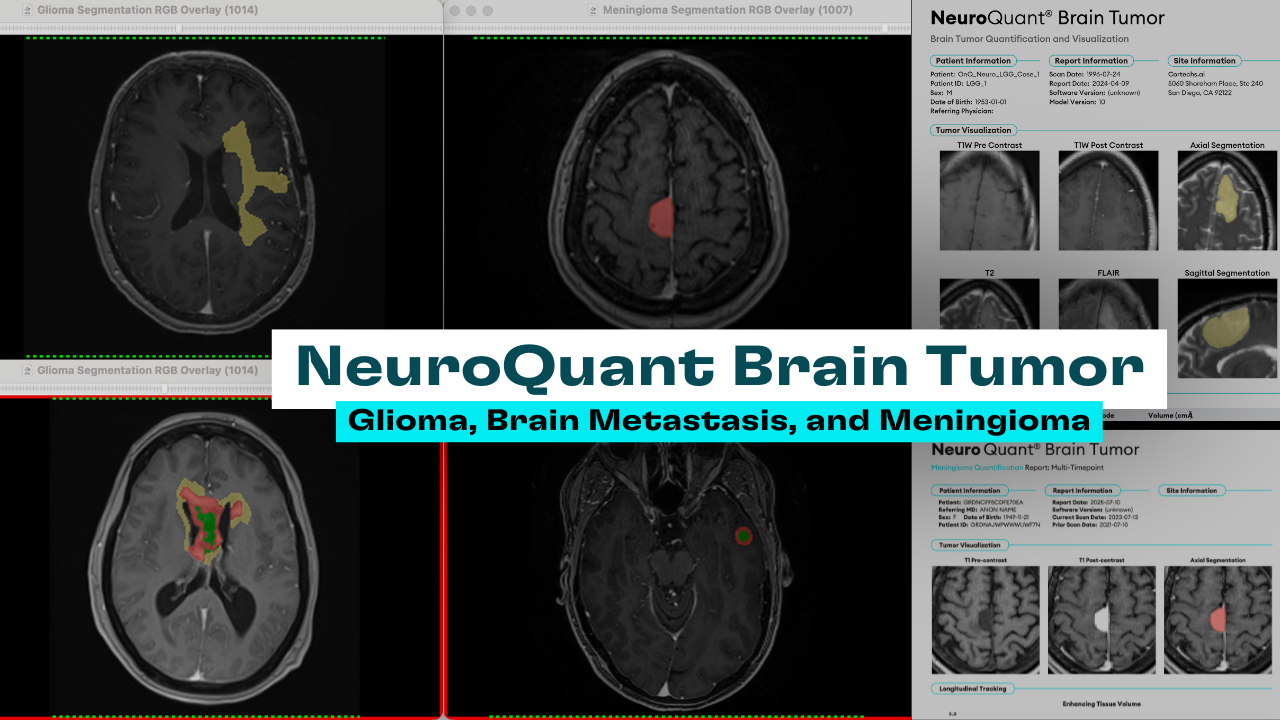 Cortechs.ai | Webinar: Using quantitative imaging for multiple sclerosis