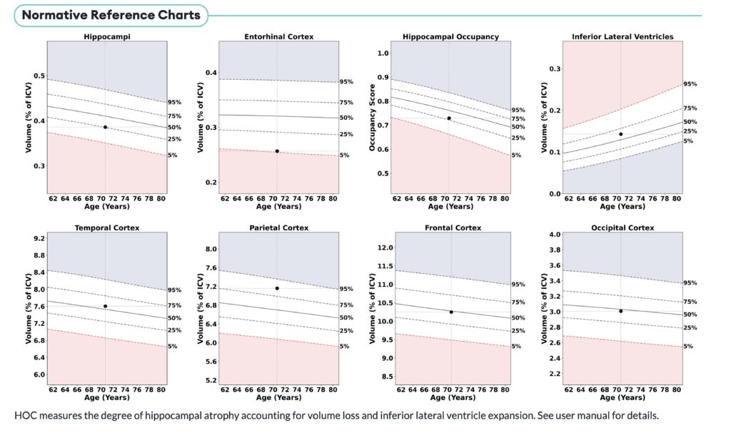 Cortechs.ai | NeuroQuant Dementia in Different Use Cases 