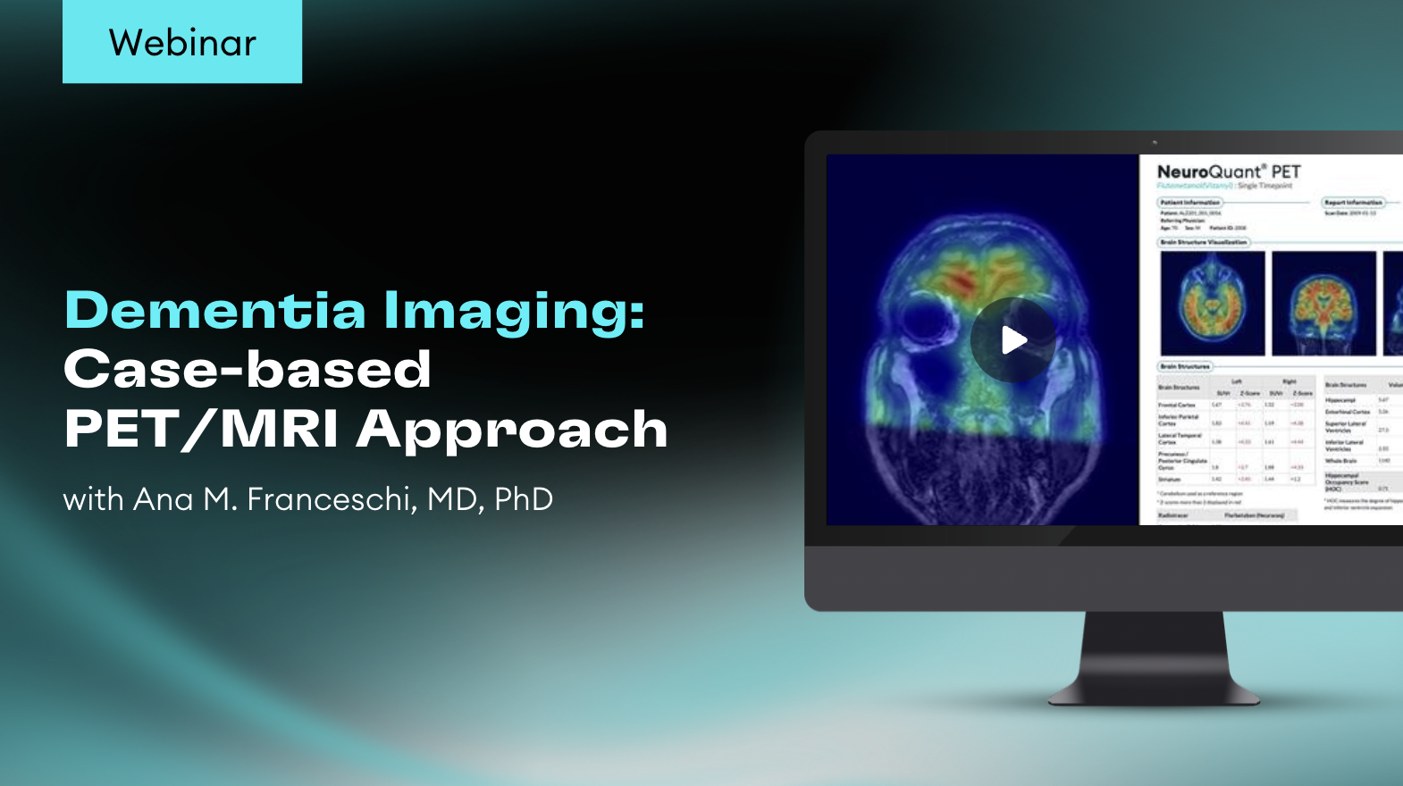 Cortechs.ai | Enhancing Clinical Workflow with NeuroQuant MS – Dr. Suzie Bash