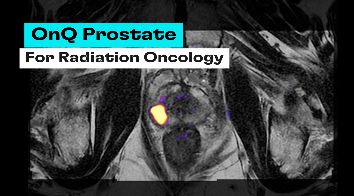 Cortechs.ai | Identifying Alzheimer’s disease with NeuroQuant