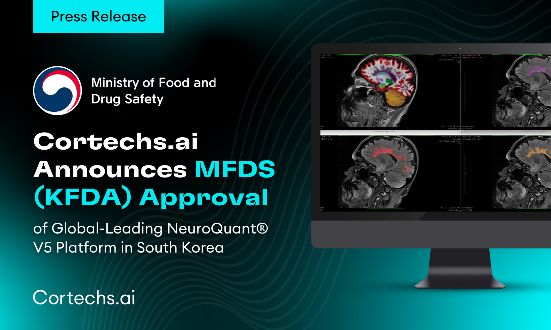Cortechs.ai | Customer Spotlight: NeuroQuant – Changing Approach to Patients with Memory Loss