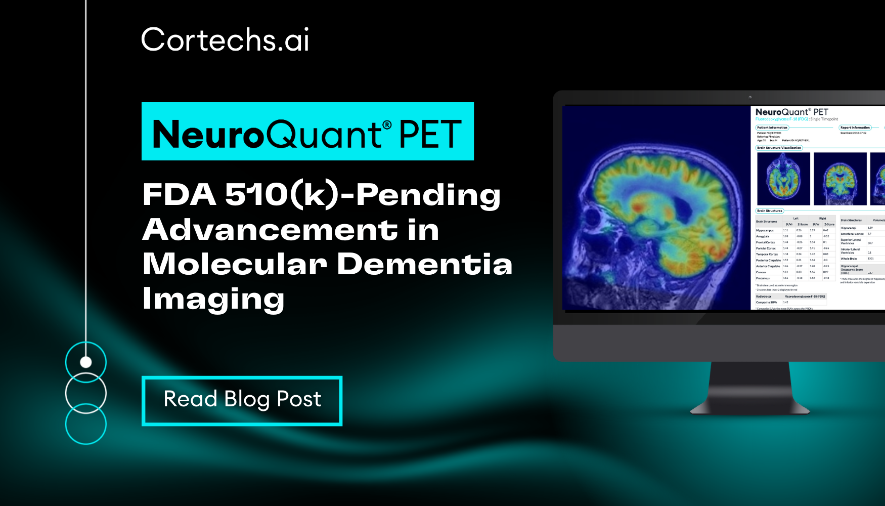 Cortechs.ai|NeuroQuant® PET: FDA 510(k)-Pending Advancement in Molecular Dementia Imaging