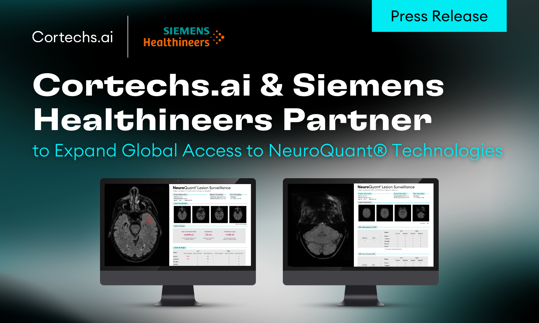 Cortechs.ai|Cortechs.ai and Siemens Healthineers Partner to Expand Global Access to NeuroQuant® Technologies