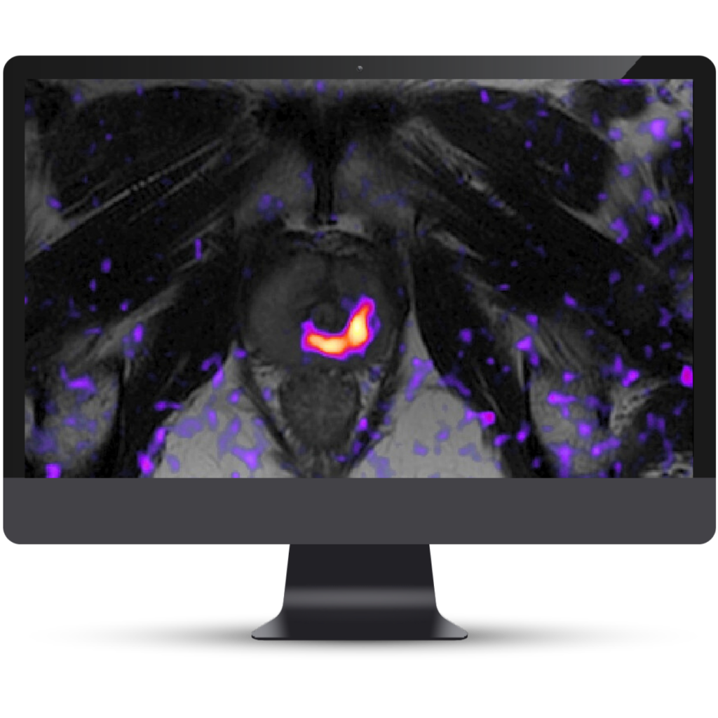 Cortechs.ai|Solutions