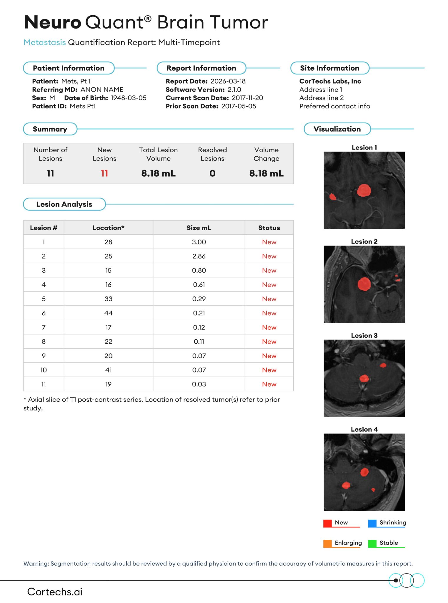 Neurowquant NeuroQuant Brain Tumor - Cortechs.ai