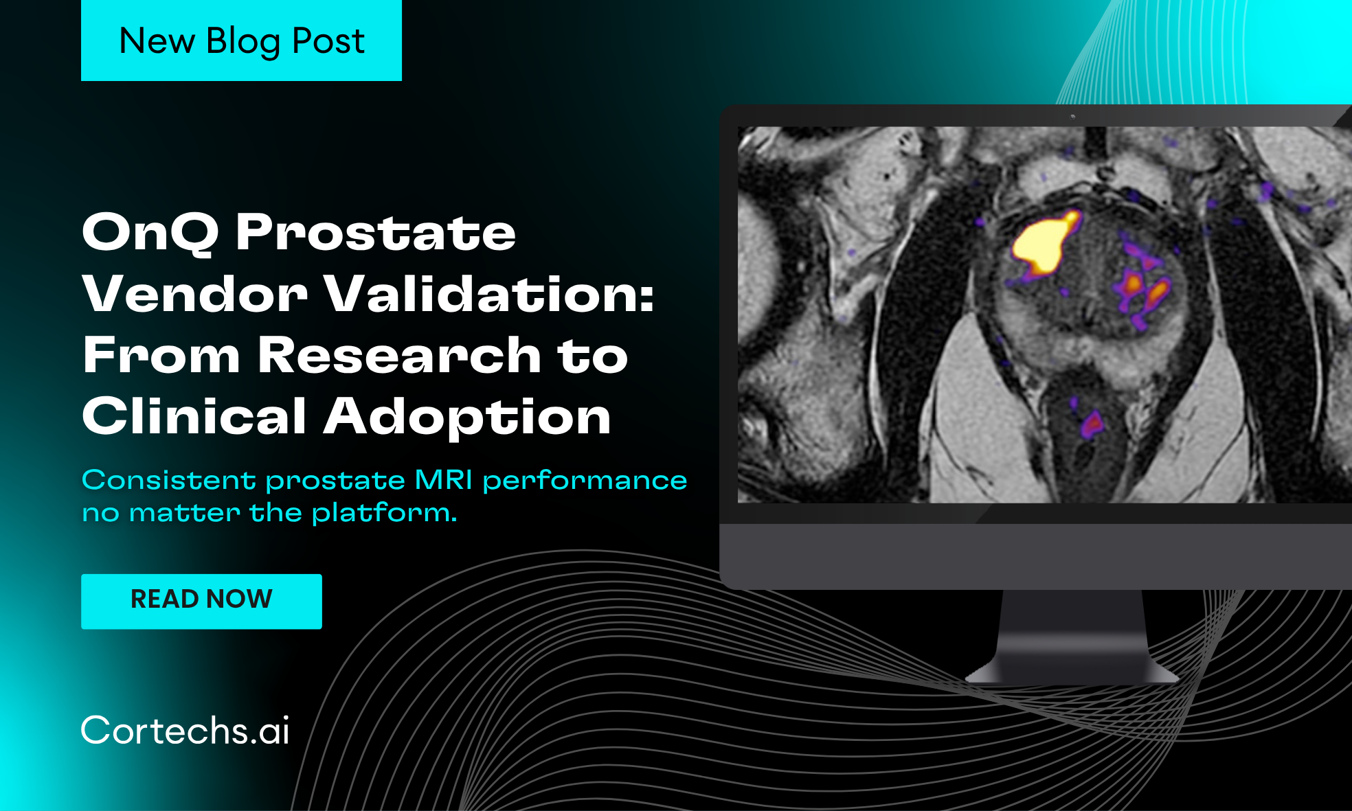 Cortechs.ai | Custom report setup – quick, easy and personalized