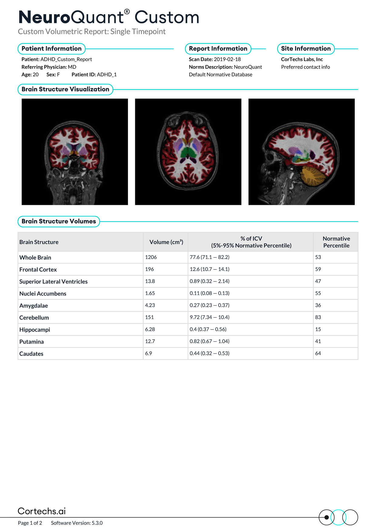 Cortechs.ai|NeuroQuant Custom Report