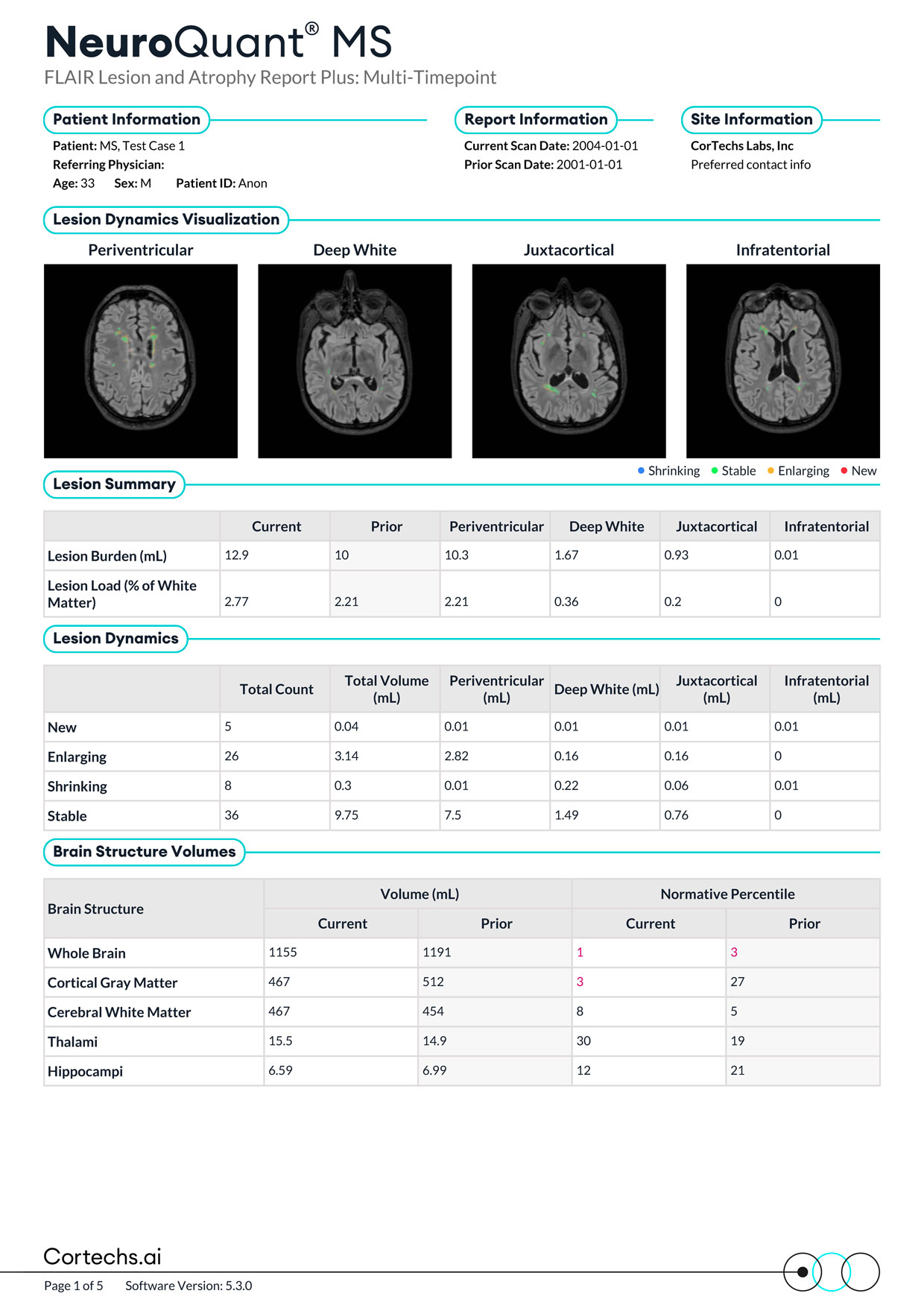 Cortechs.ai|NeuroQuant MS FLAIR Lesion and Atrophy Report PLUS