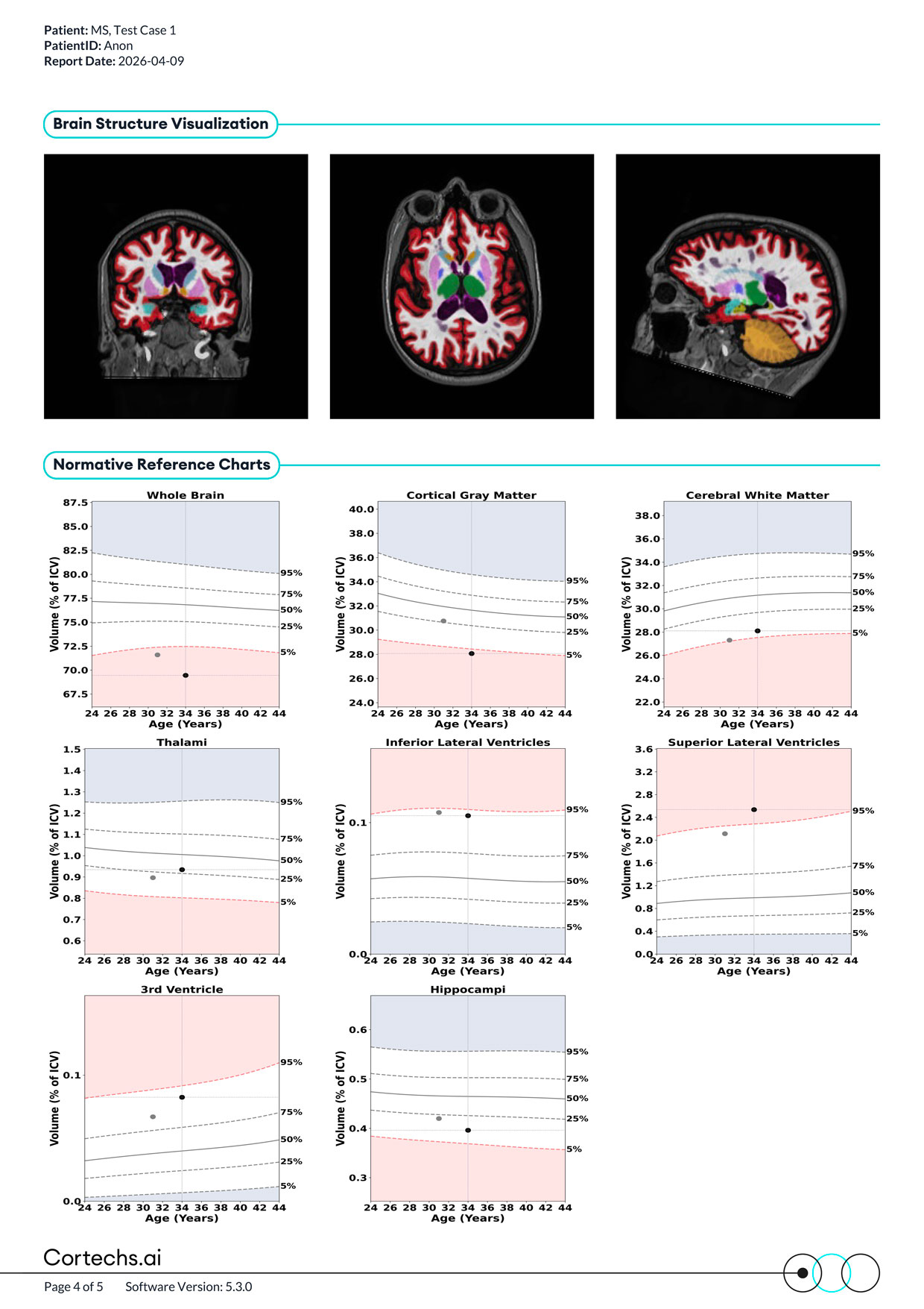 Cortechs.ai|NeuroQuant MS FLAIR Lesion and Atrophy Report PLUS