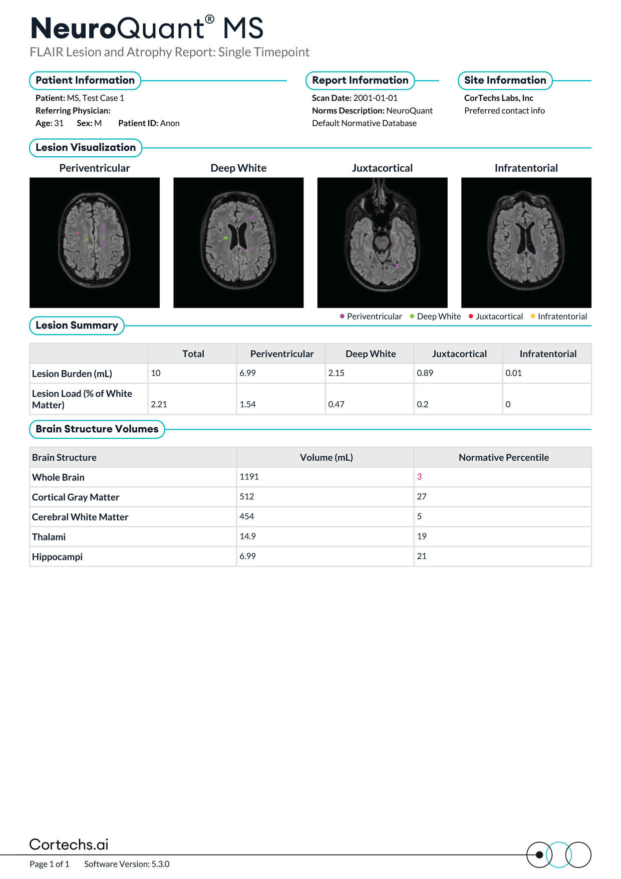 Cortechs.ai|NeuroQuant MS FLAIR Lesion and Atrophy Report