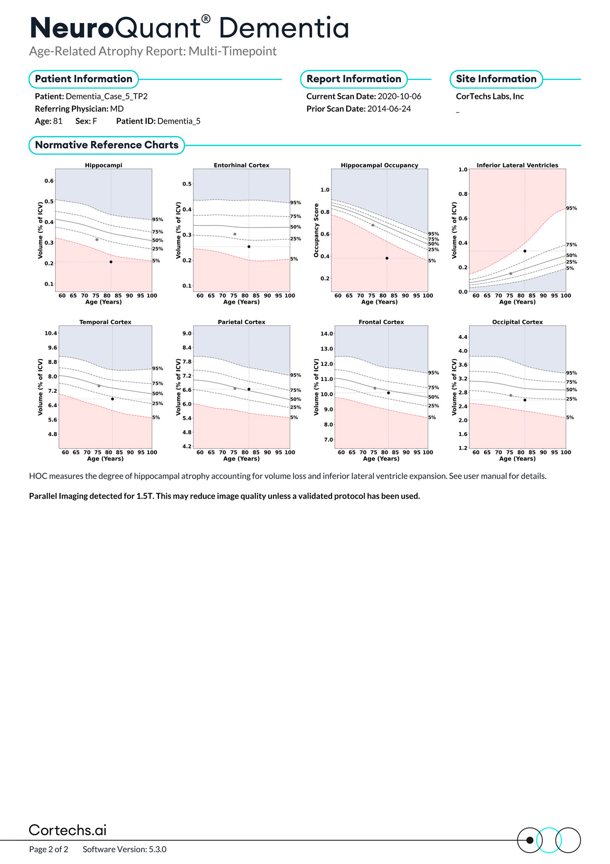 Cortechs.ai|NeuroQuant Dementia Report