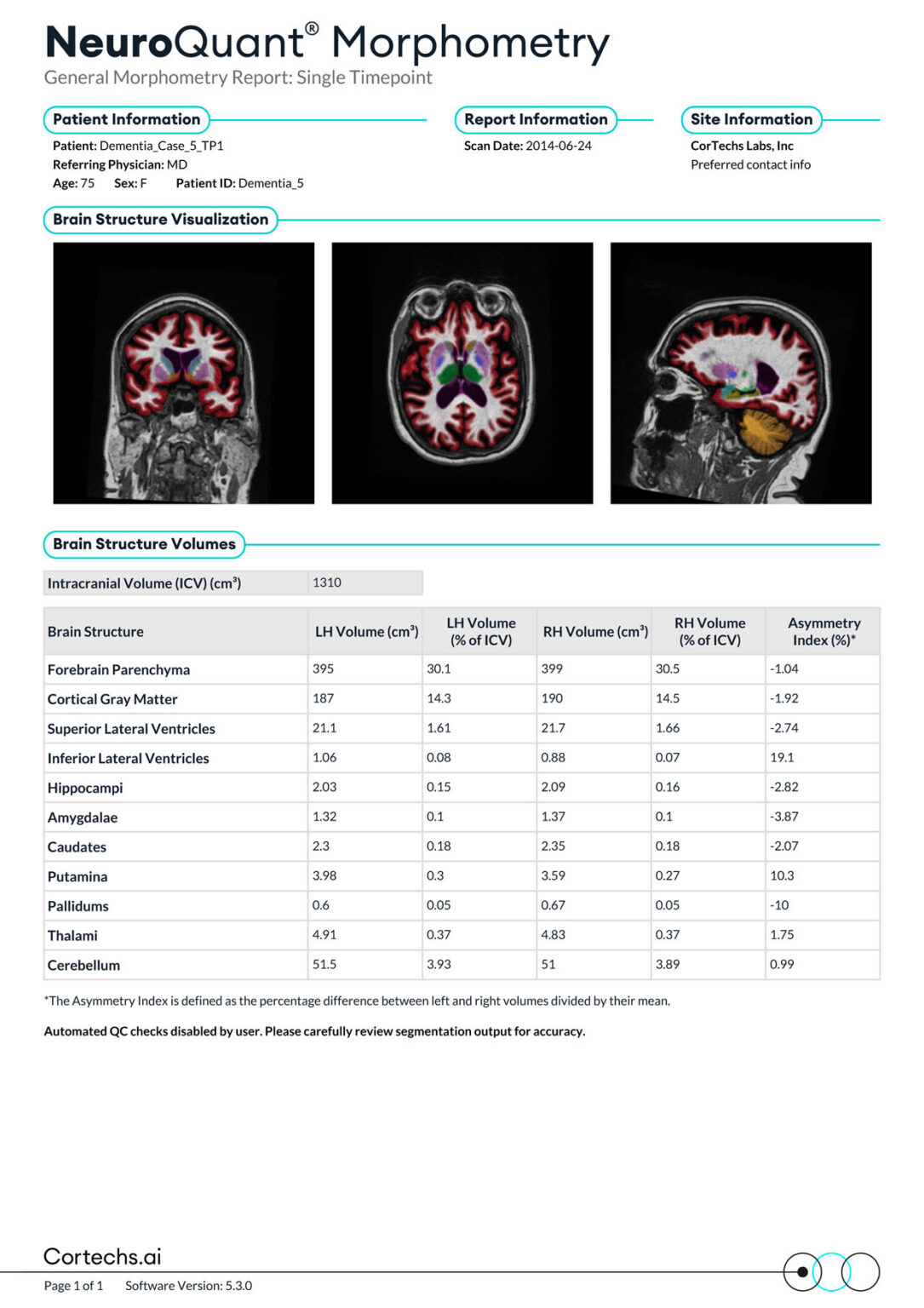 NeuroQuant General Report - Cortechs.ai
