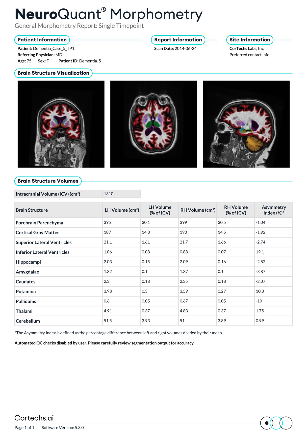 Cortechs.ai|NeuroQuant General Report