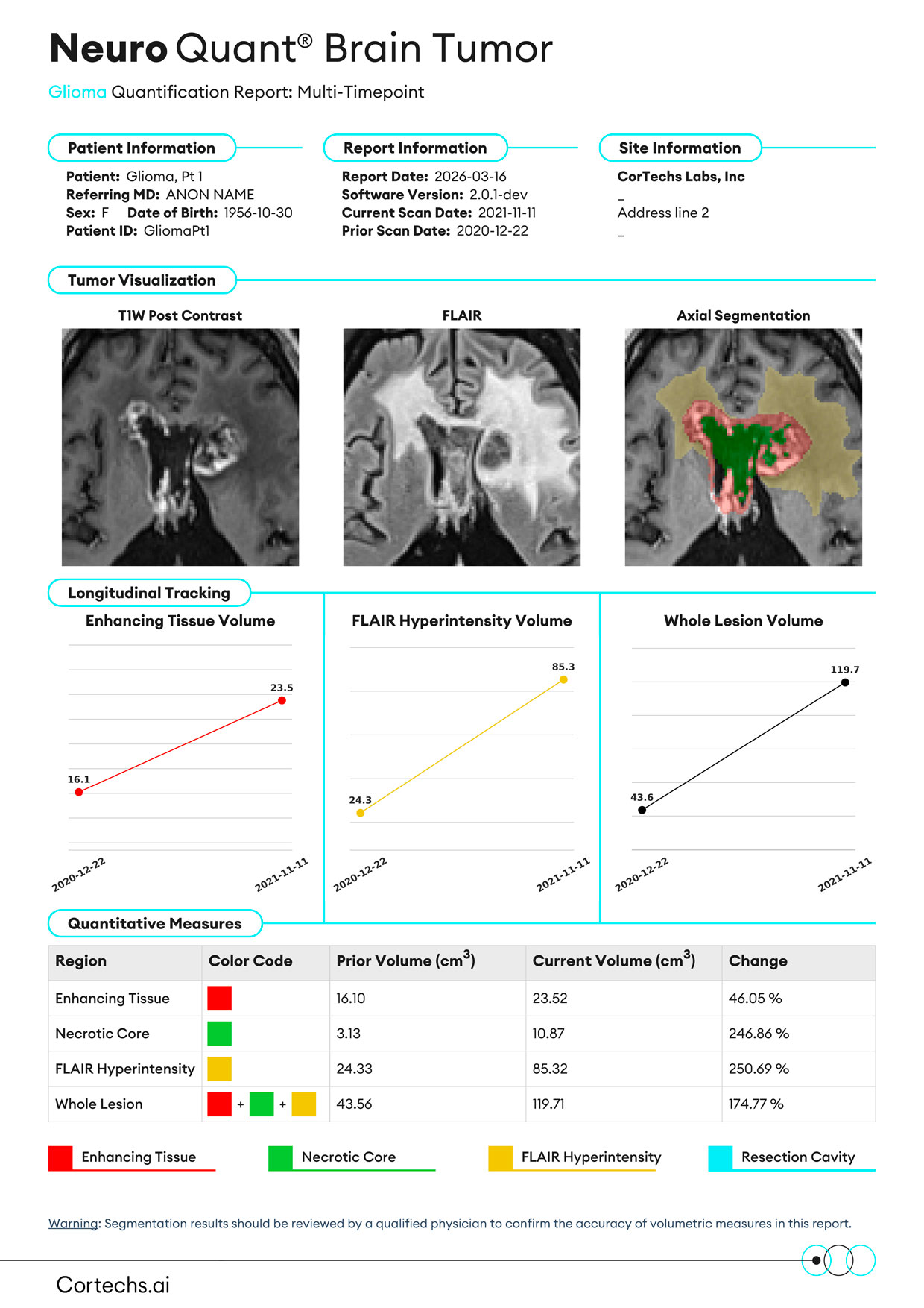 Cortechs.ai|NeuroQuant Brain Tumor Glioma Report