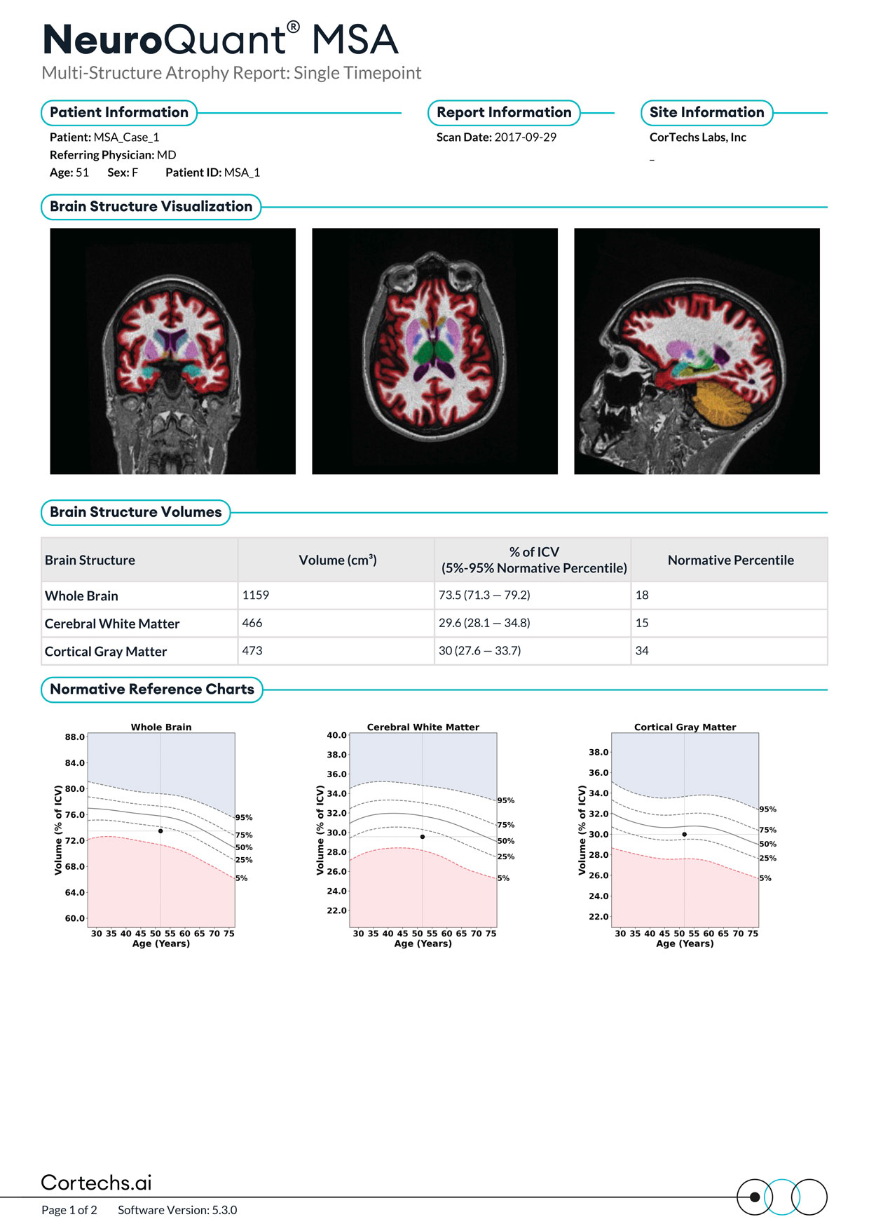 Cortechs.ai|NeuroQuant MSA Report