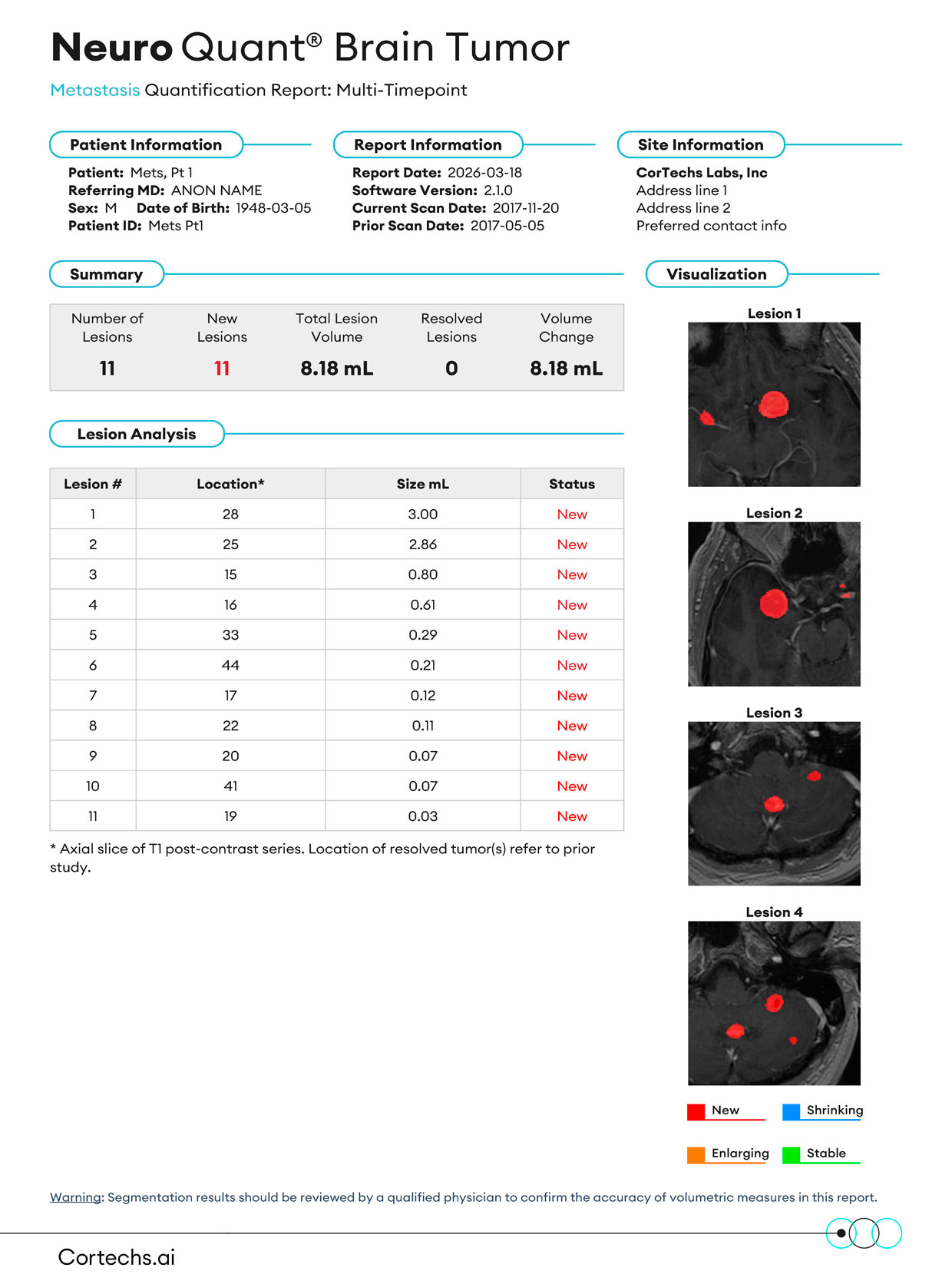 Cortechs.ai|NeuroQuant Brain Tumor Metastasis Report