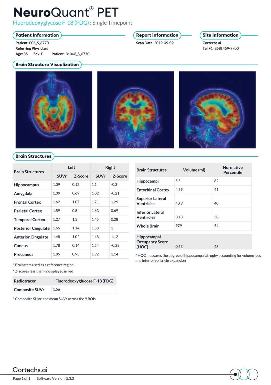 Neurowquant NeuroQuant PET FDG Report - Cortechs.ai