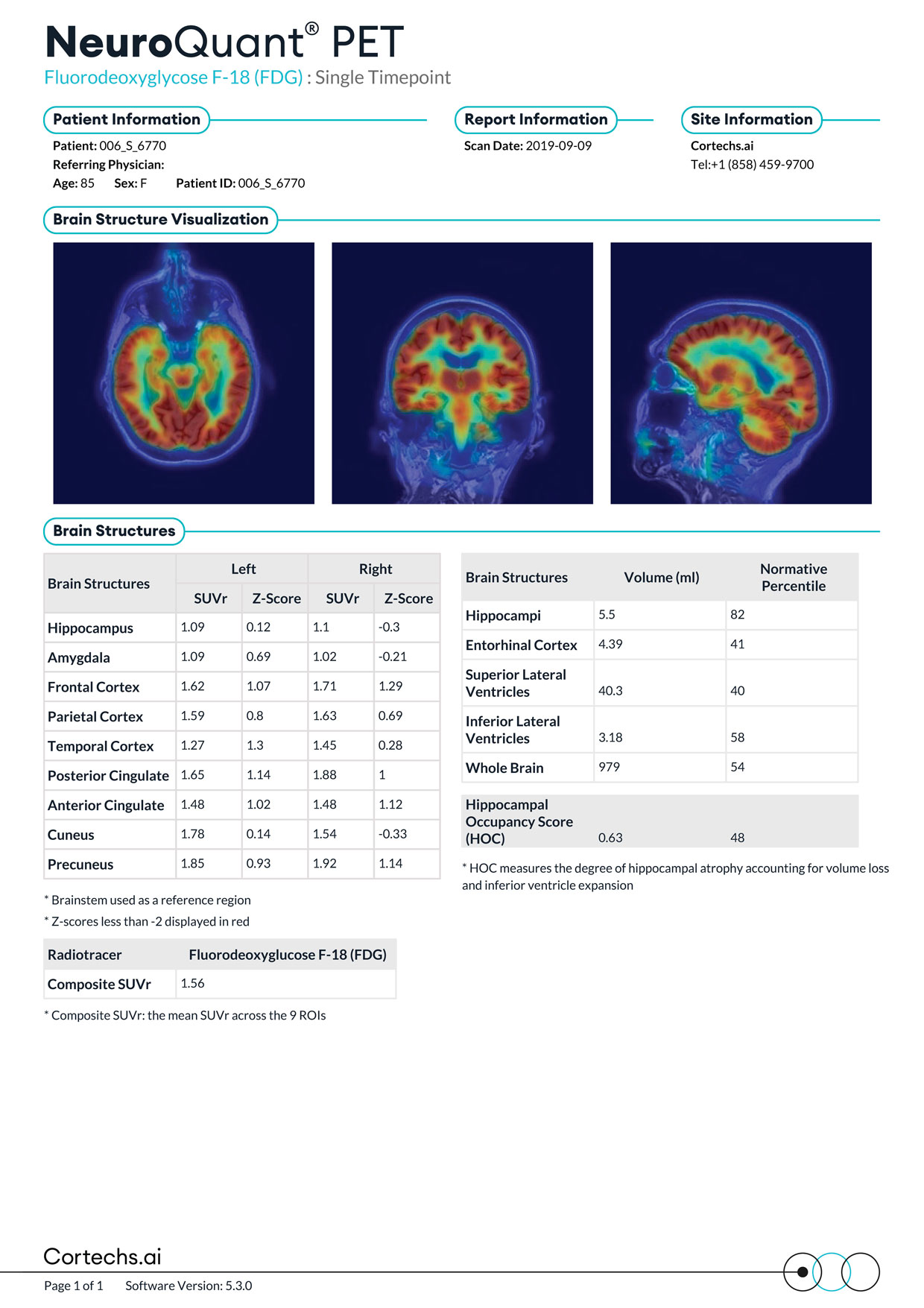 Cortechs.ai|NeuroQuant PET FDG Report