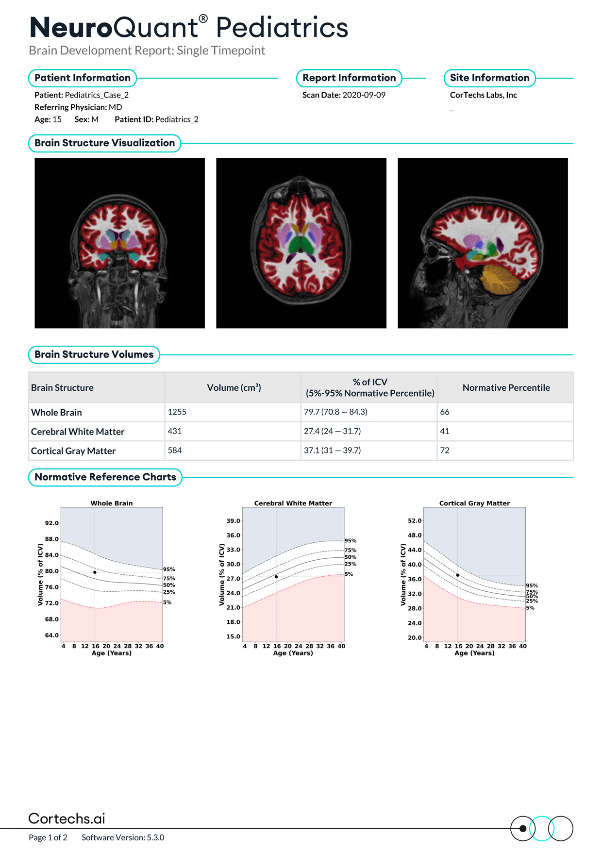 Cortechs.ai|NeuroQuant Pediatrics Report