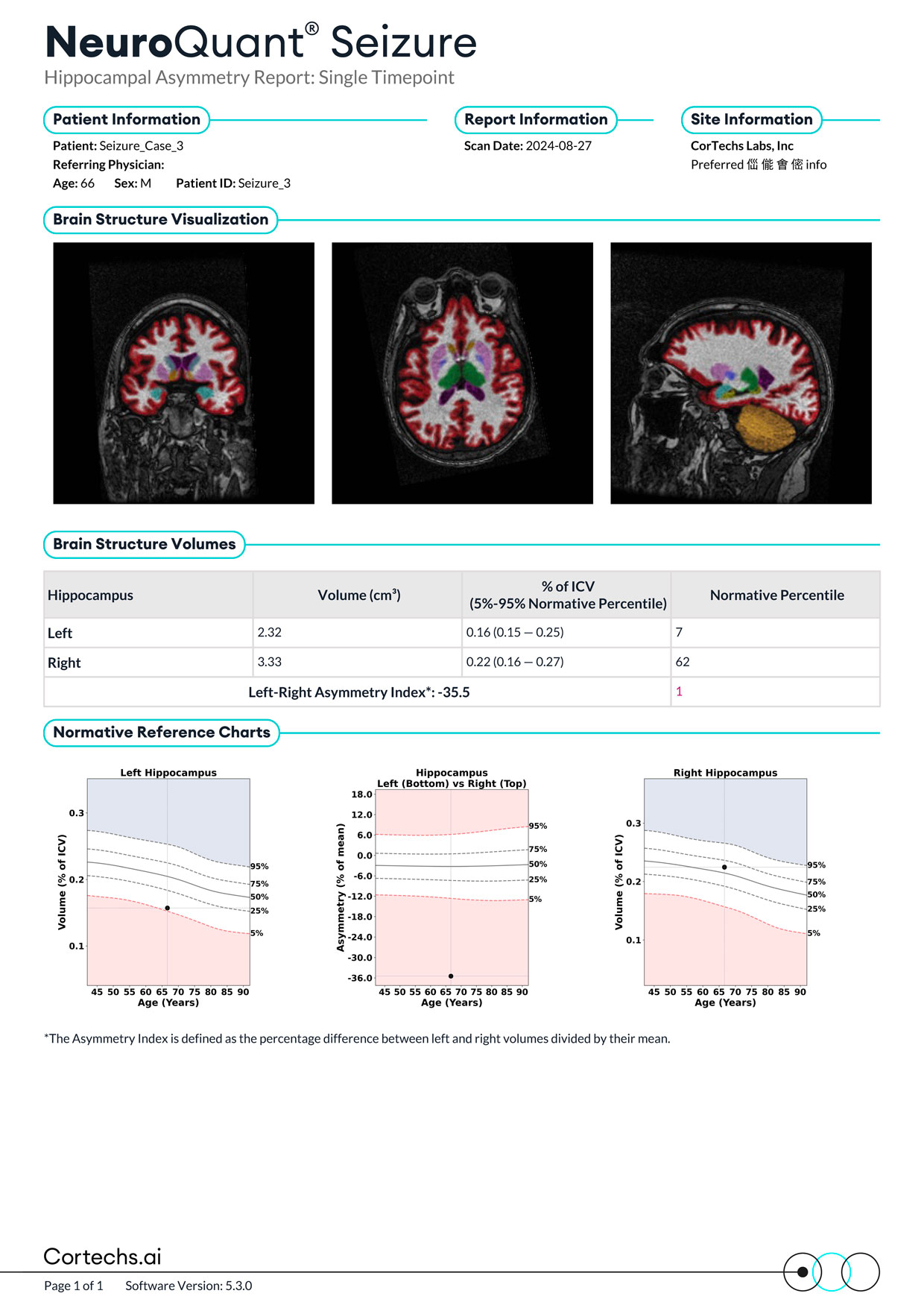 Cortechs.ai|NeuroQuant Seizure Report