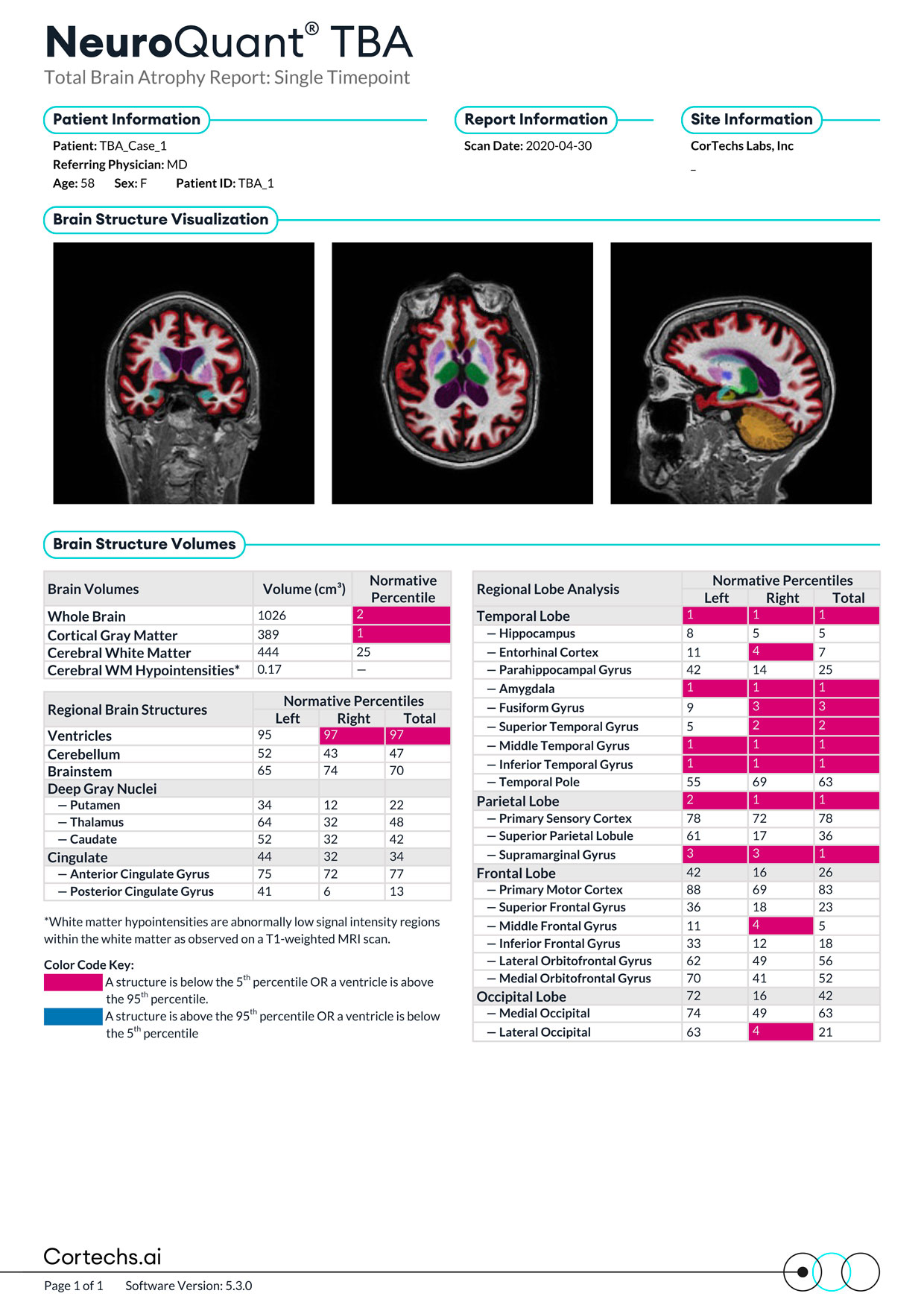 Cortechs.ai|NeuroQuant TBA Report