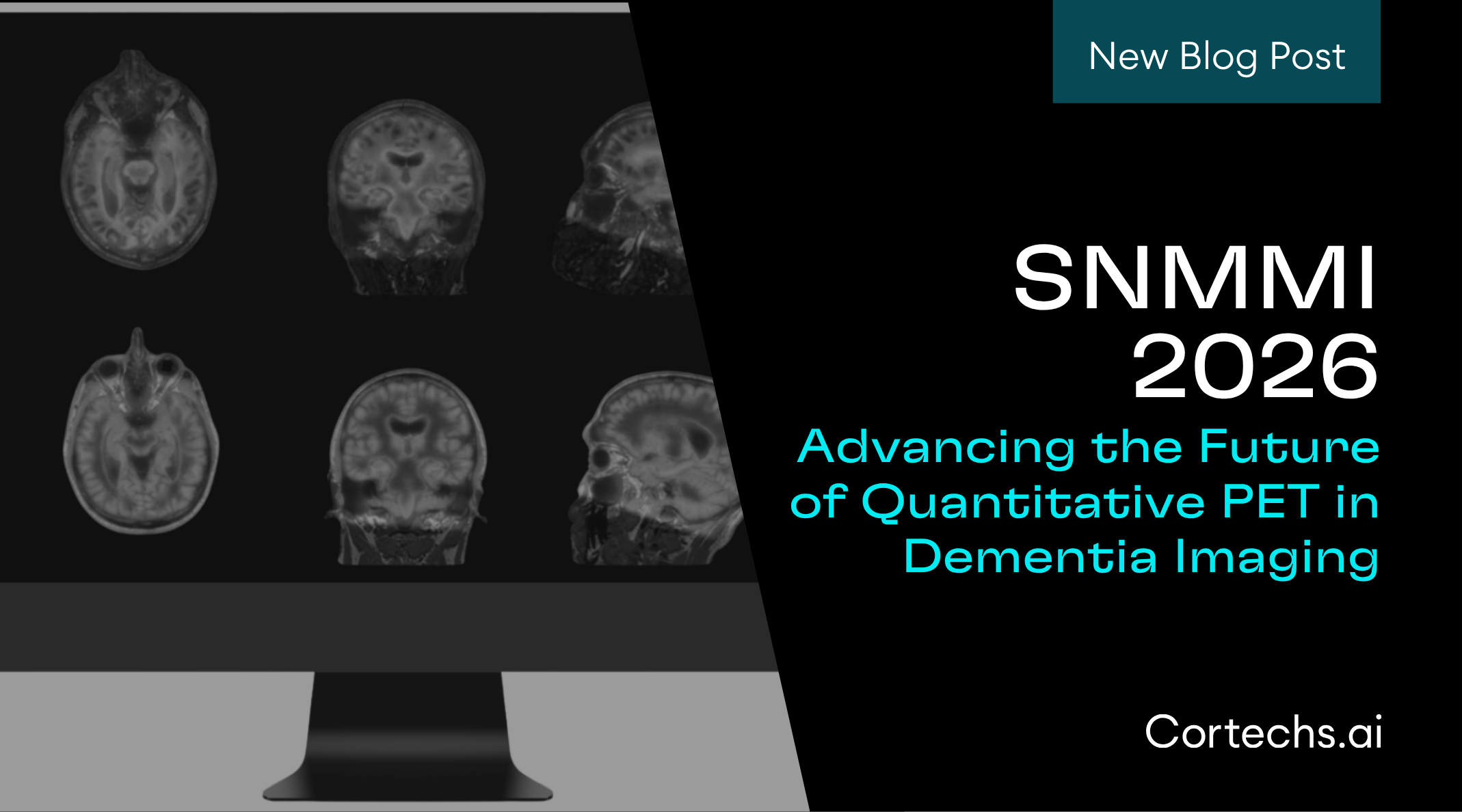 Cortechs.ai | Enhancing Brain Tumor Treatment with RT STRUCT Images: The Promise of Automation