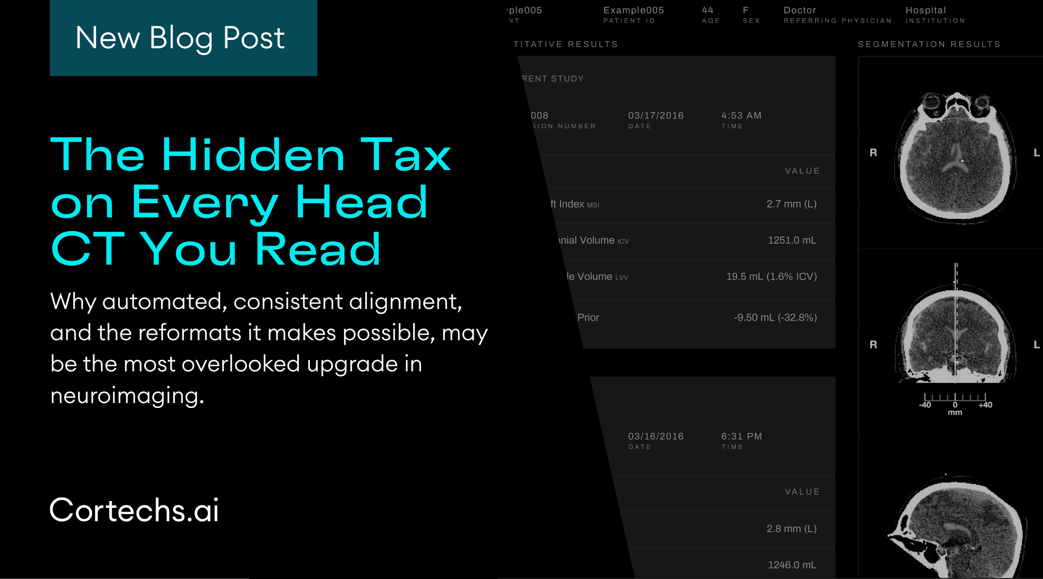 Cortechs.ai|The Hidden Tax on Every Head CT You Read