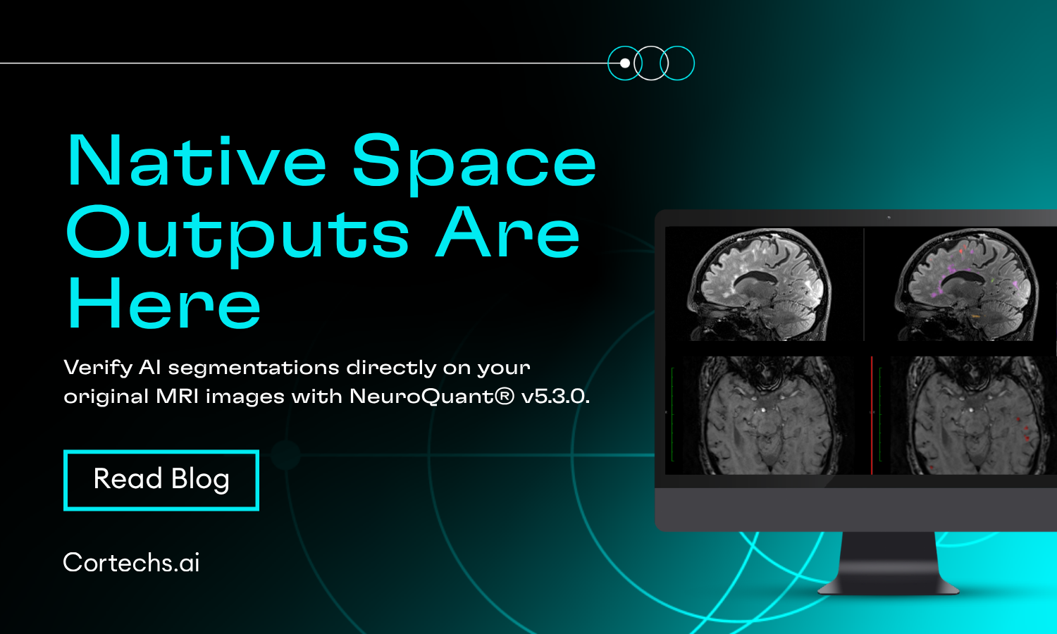 Cortechs.ai|Read Your Segmentations in the Same Space You Read the Study: Native Space Outputs in NeuroQuant v5.3.0