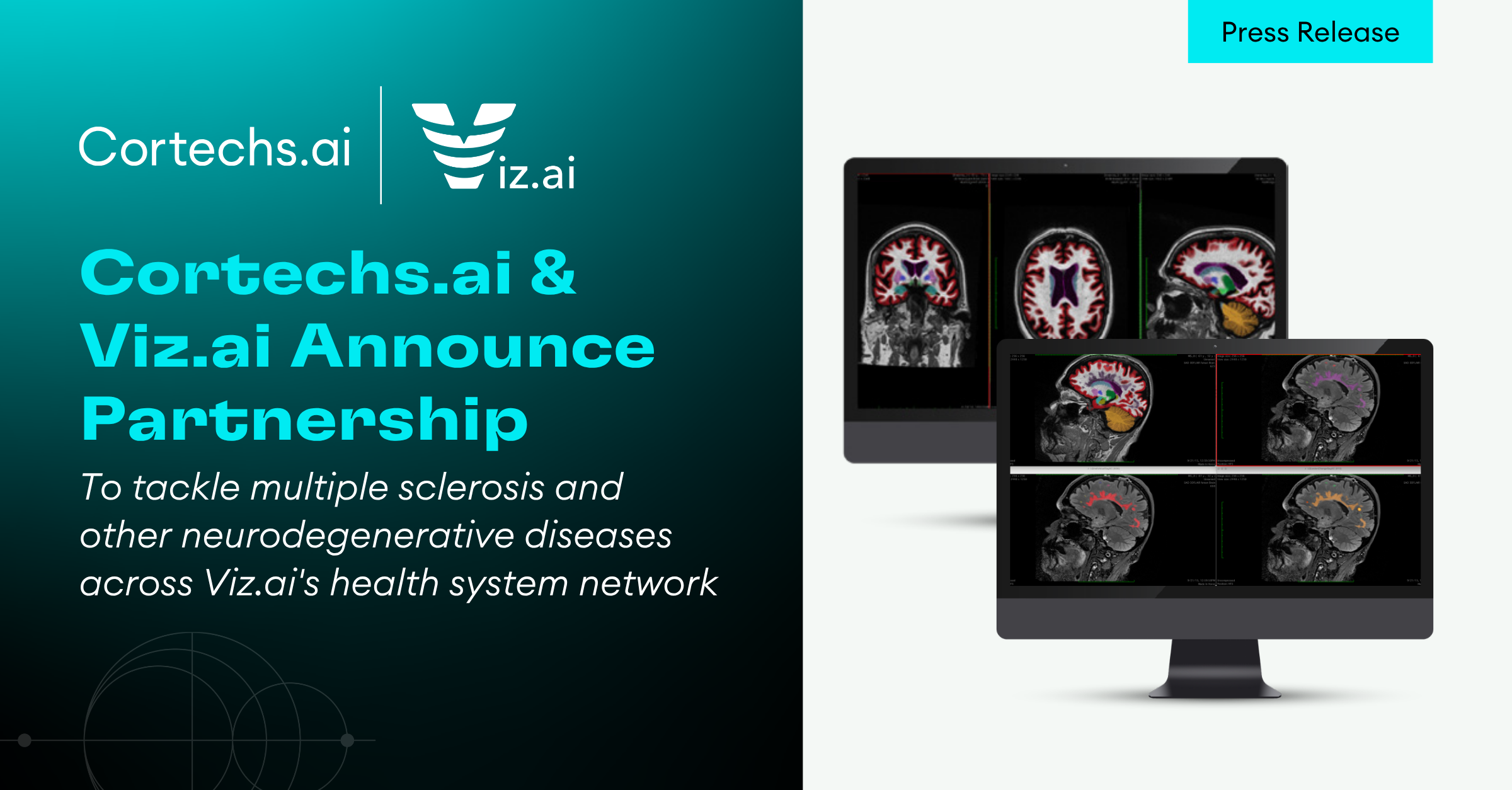 Cortechs.ai | Are you using NeuroQuant&reg; in research?