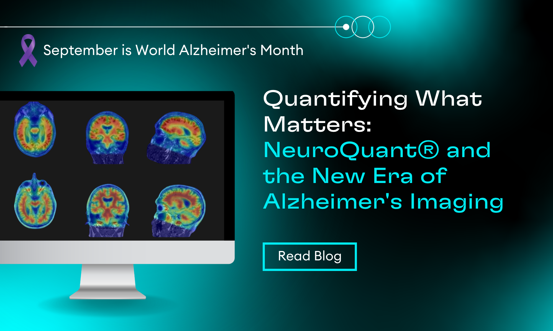 Cortechs.ai | Quantitative MR volumetry in temporal lobe epilepsy