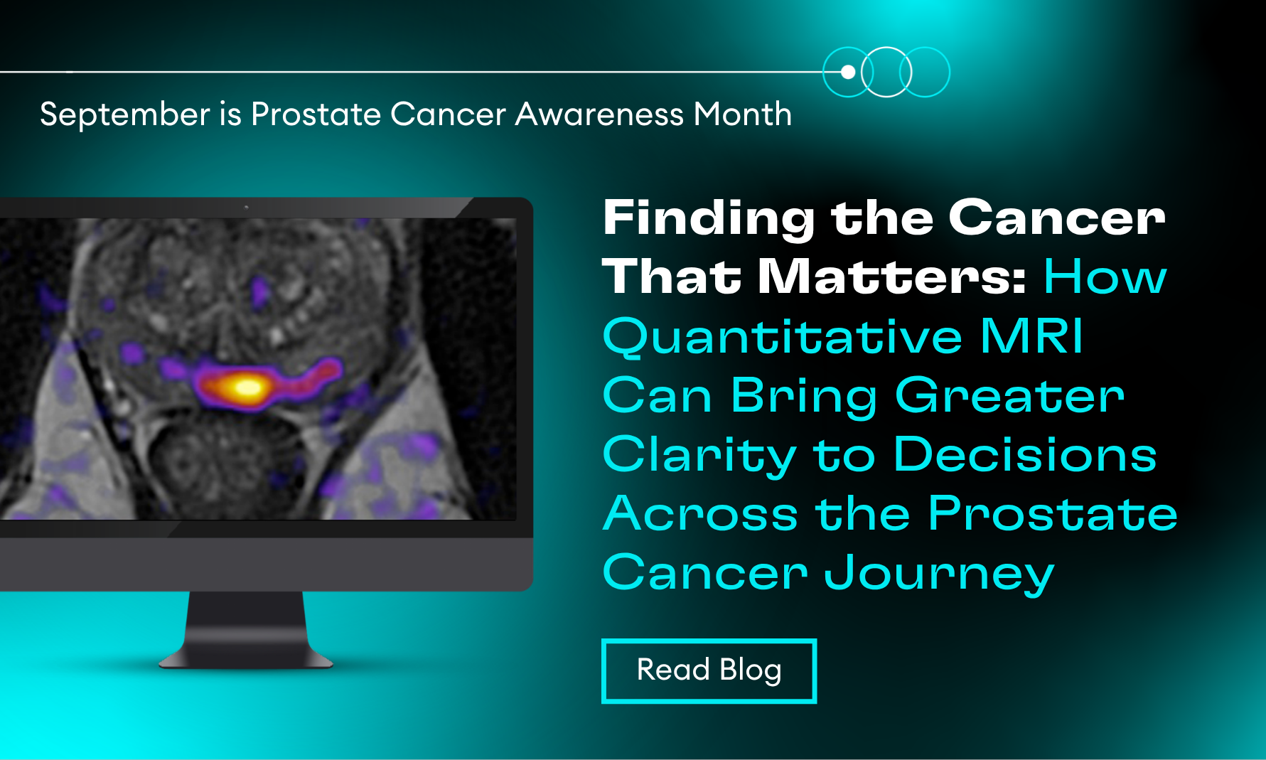 Prostate Cancer Awareness Month