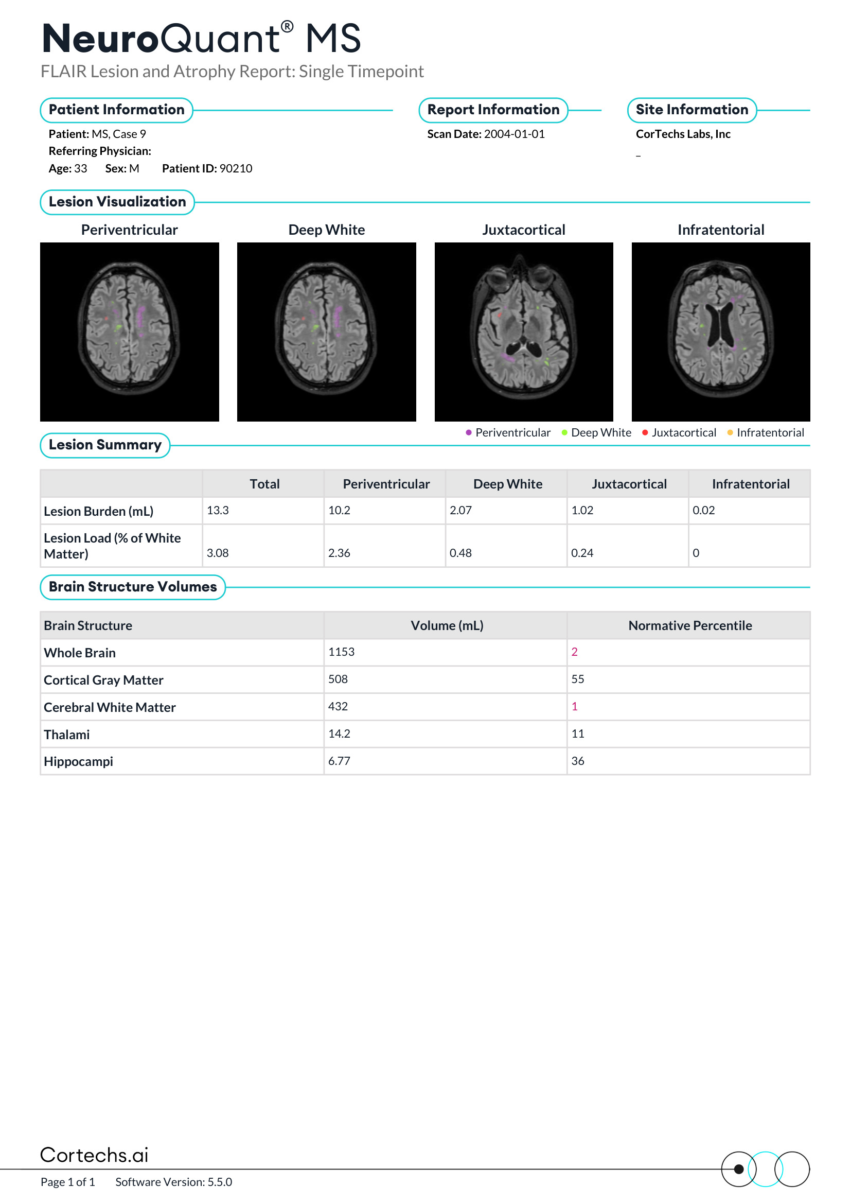 Cortechs.ai|NeuroQuant MS FLAIR Lesion and Atrophy Report