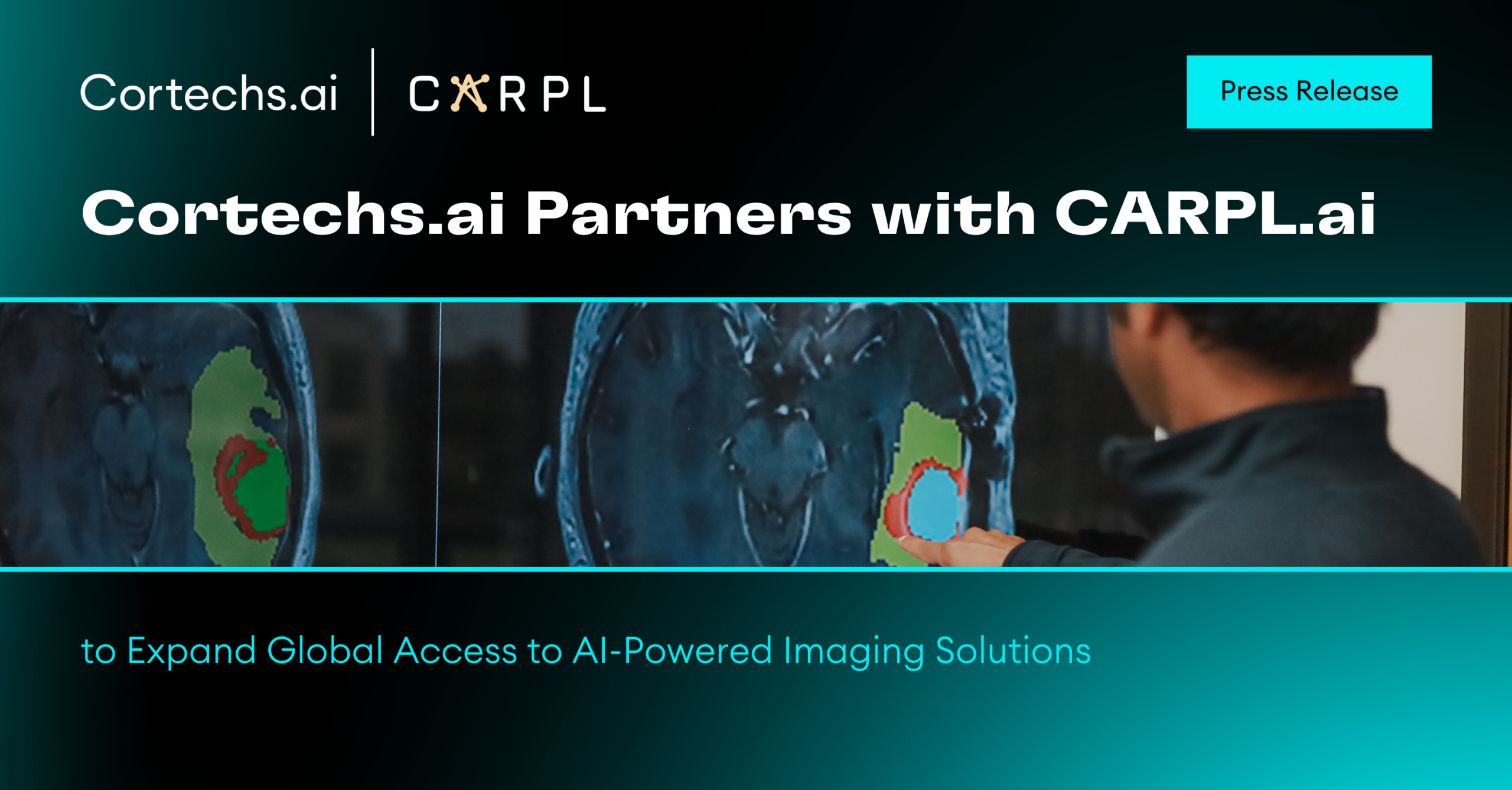 Cortechs.ai | OnQ&reg; Prostate: supporting cancer detection