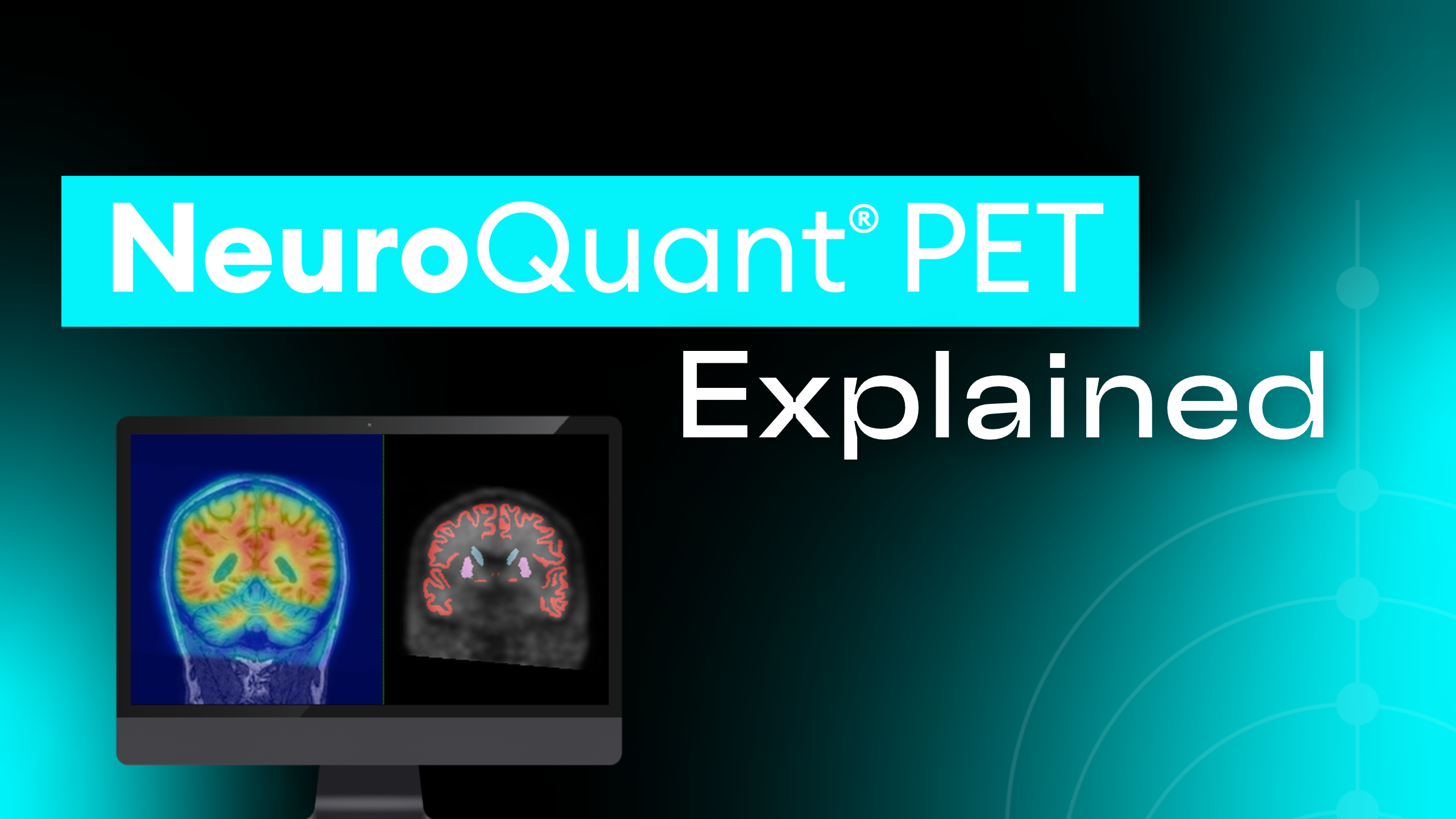 Cortechs.ai | Webinar: Quantitative imaging for dementia